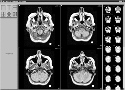 The Thumbnail Implementation